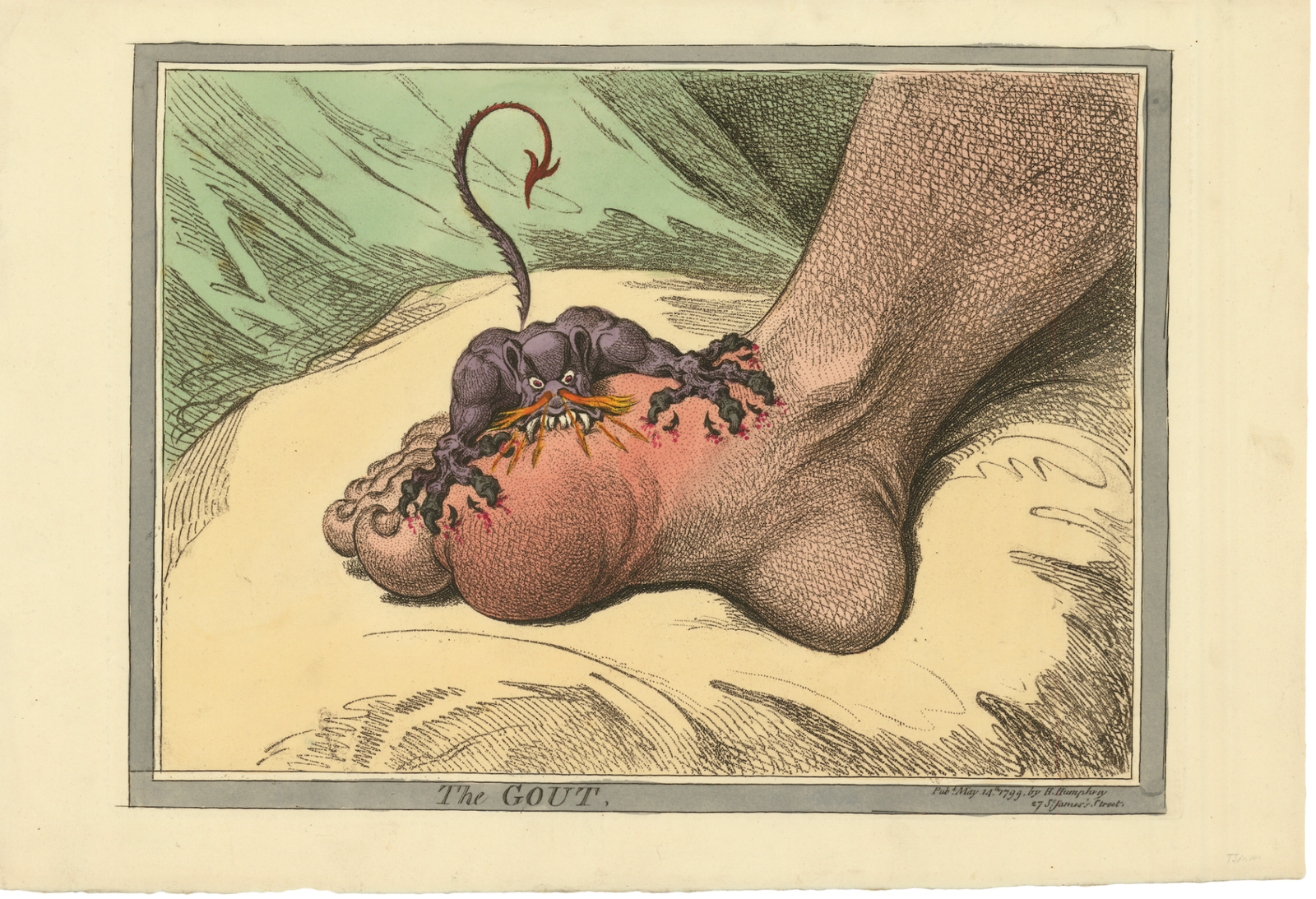 The Gout, a satirical print by James Gillray, 1799